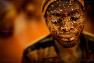 The price of gold